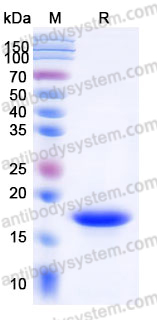 Recombinant Human MAP1LC3A Protein, C-His