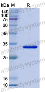 Recombinant Human WNK1 Protein, N-His