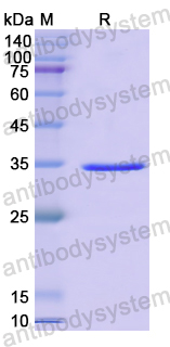Recombinant Human DPEP3 Protein, N-His