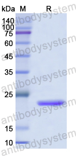 Recombinant Human ECT2 Protein, N-His