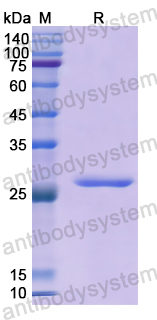 Recombinant Human CDH20 Protein, N-His