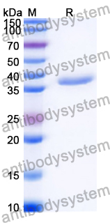 SDS-PAGE for Recombinant Human MUC5B Protein, N-GST ?>