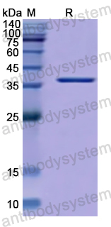 Recombinant Human S100A14 Protein, N-GST