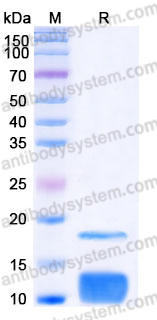 Recombinant Human RETN/Resistin Protein, C-His