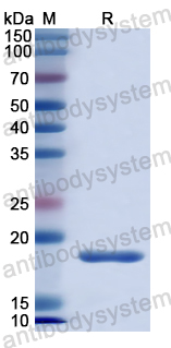 Recombinant Human NPHS2 Protein, N-His