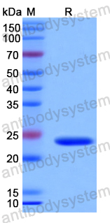 Recombinant Human IL1RAP Protein, N-His