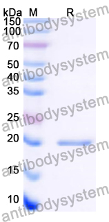 Recombinant Human ESM1 Protein, N-His