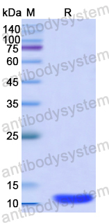 Recombinant Human CTNNBIP1 Protein, N-His