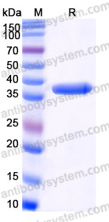 Recombinant Human ATG3 Protein, Tag free