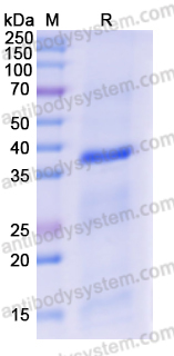 Recombinant Human TLR7 Protein, N-His