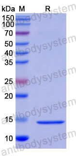 Recombinant Human AHSP Protein, N-His