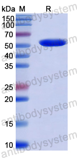 Recombinant Human HSPBP1 Protein, N-GST