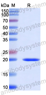 Recombinant Human LRP1B Protein, N-His