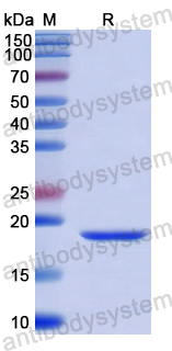 Recombinant Human CALML5 Protein, N-His