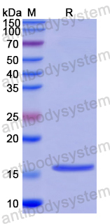 Recombinant Human DSPP Protein, N-His
