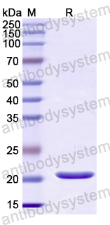 Recombinant Human MPP6 Protein, N-His