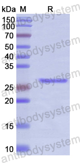 Recombinant Human PDP1 Protein, N-His