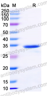 Recombinant Human MBD2 Protein, N-His