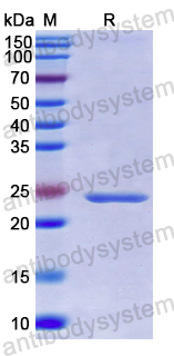 Recombinant Human CLCF1 Protein, N-His
