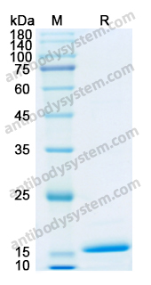 Recombinant Human IL36RN Protein, N-His
