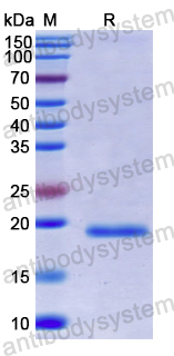 Recombinant Human UXT Protein, N-His