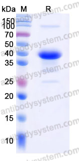 Recombinant Human UPB1 Protein, C-His
