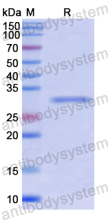 Recombinant Human RPS6KB2 Protein, N-His