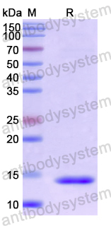 Recombinant Human DKK4 Protein, N-His
