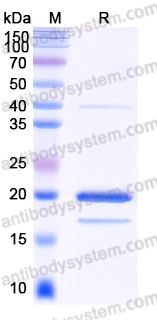 Recombinant Human HSPB7 Protein, C-His