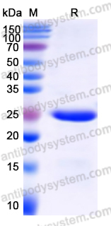 Recombinant Human MARCO Protein, N-His-SUMO