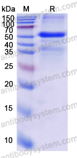 Recombinant Human STK39 Protein, N-His