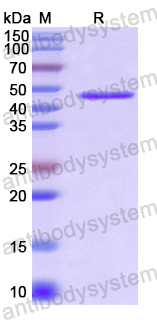 Recombinant Human DMBT1 Protein, N-His