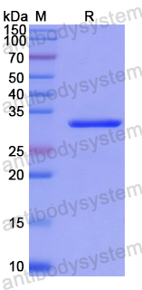 Recombinant Human HMGXB4 Protein, N-His