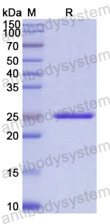 Recombinant Human APOBEC3B Protein, N-His