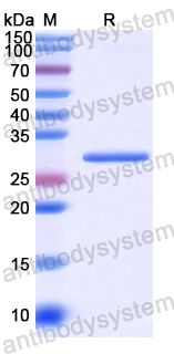 Recombinant Human EGFL7 Protein, N-His