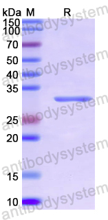 Recombinant Human APPL1 Protein, N-His