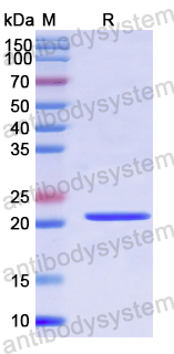 Recombinant Human MCTS1 Protein, N-His