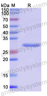 Recombinant Human MTUS1 Protein, N-His