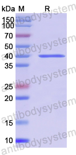 Recombinant Human WWC3 Protein, N-GST
