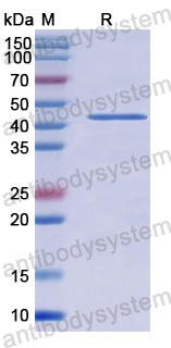 Recombinant Human CNOT6 Protein, N-His