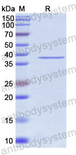 Recombinant Human HSF4 Protein, N-GST