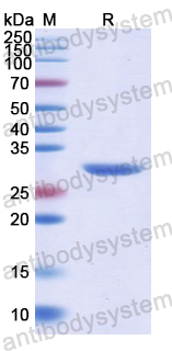 Recombinant Human RNF112 Protein, N-His