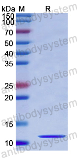Recombinant Human ASC/TMS1/PYCARD Protein, N-His