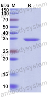 Recombinant Human PADI4 Protein, N-His