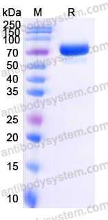 Recombinant Human PADI4 Protein, N-His