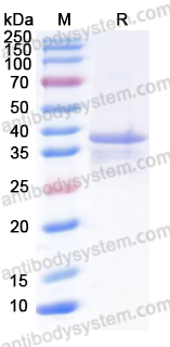 Recombinant Human CD246/ALK Protein, N-His