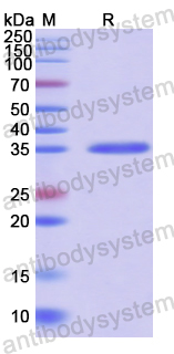 Recombinant Human COL17A1 Protein, N-GST