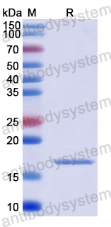 Recombinant Human ADAMTS5 Protein, N-His