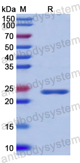 Recombinant Human SMC3 Protein, N-His