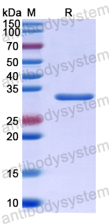 Recombinant Human PDE10A Protein, N-His